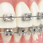 Orthodontics